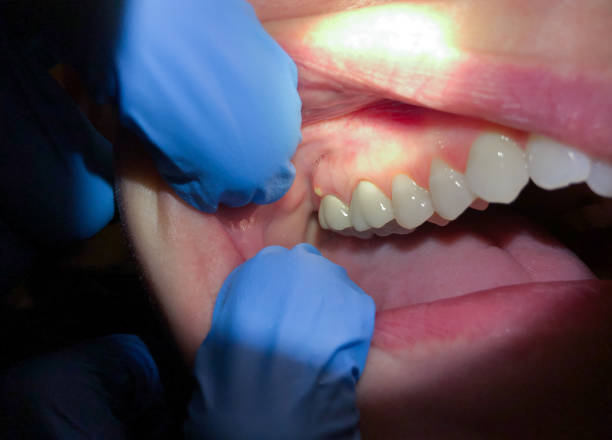 Best Walk-In Emergency Dental Services in Baltimore, MD